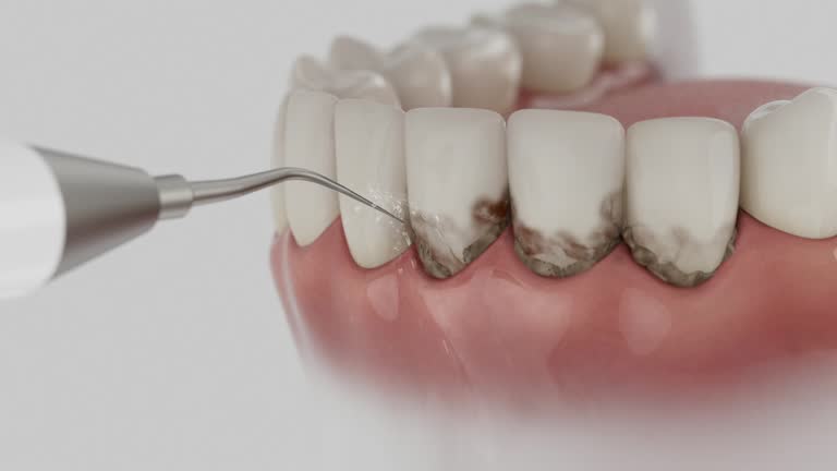 Trusted Teeth Cleaning And Checkup service in The Hills, TX - Dentist Open Now